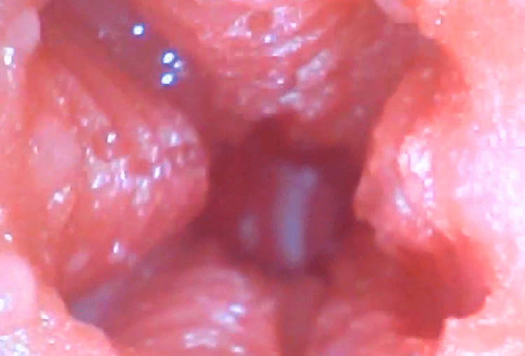 Cốc thủ dâm d6.gif